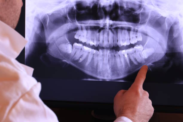 Best Emergency Gum Treatment in Pryor Creek, OK