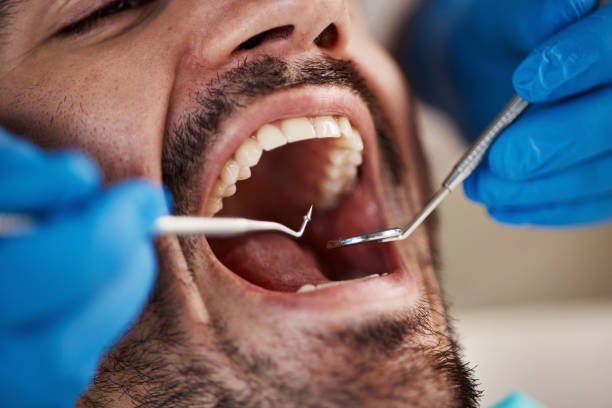 Best Emergency Denture Repair in Pryor Creek, OK